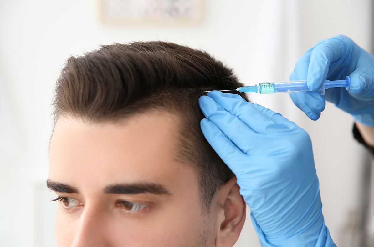 کاشت مو یا روش‌های جایگزین؟ بهترین انتخاب برای مقابله با ریزش مو