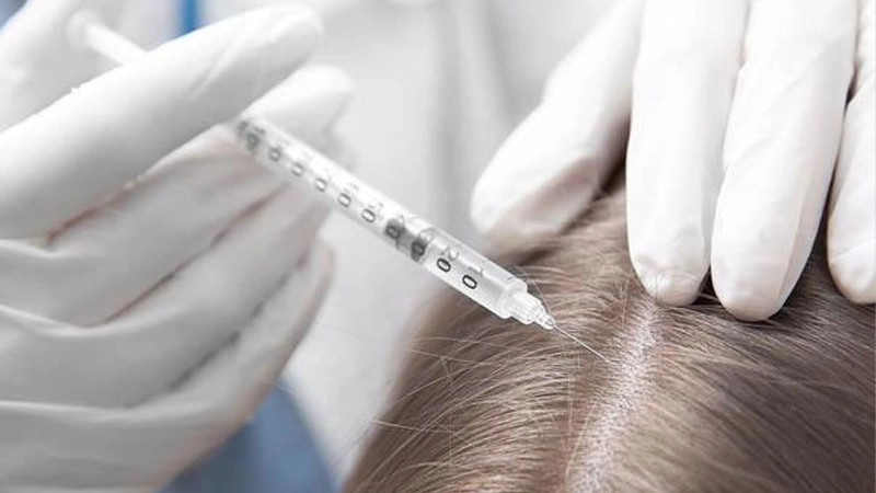 کربوکسیتراپی (Carboxytherapy)