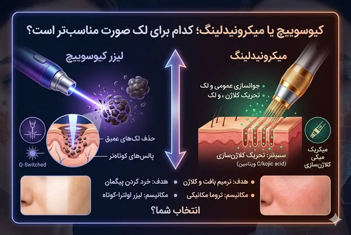 کیوسوییچ یا میکرونیدلینگ؛ کدام برای لک صورت مناسبتر است