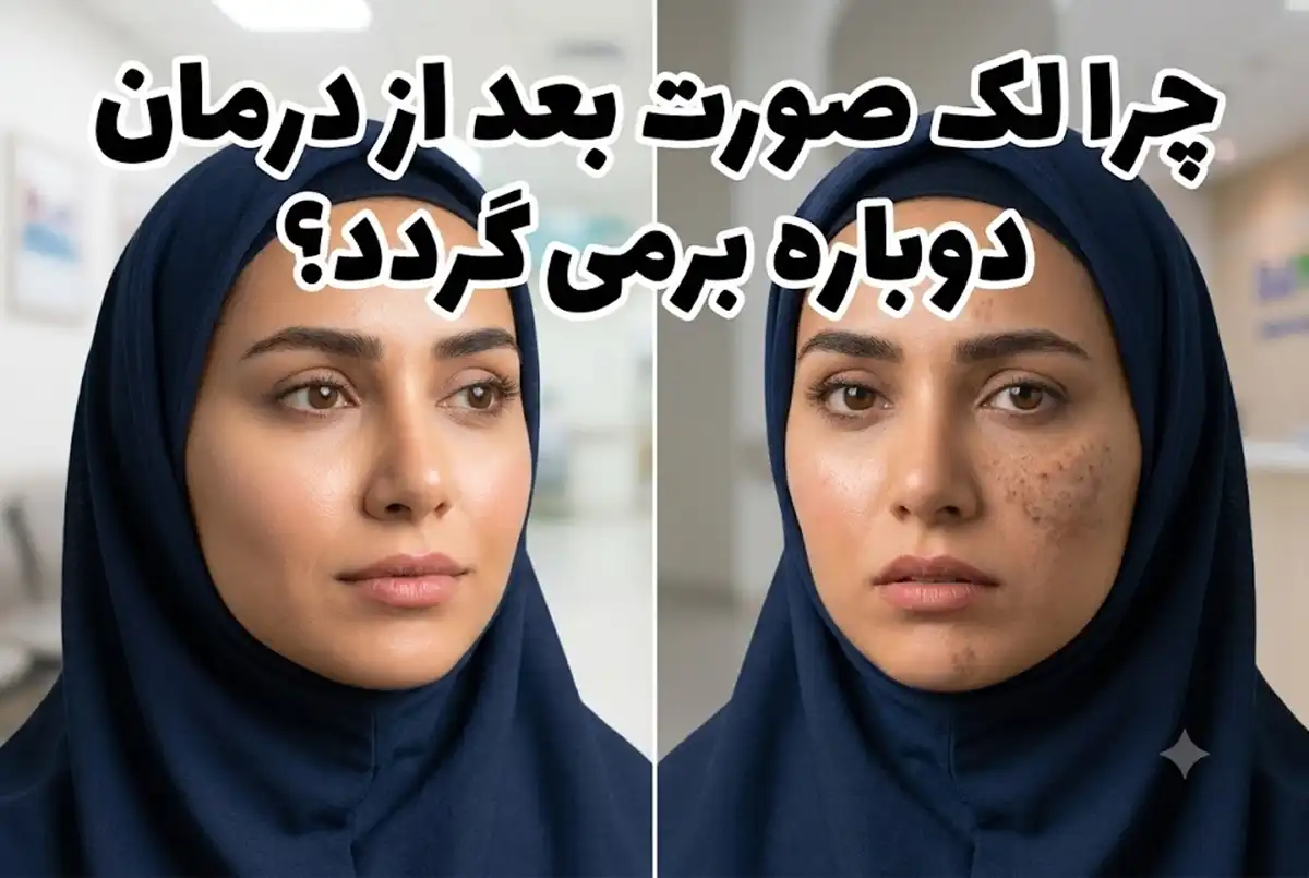 چرا لک صورت بعد از درمان دوباره برمی گردد؟