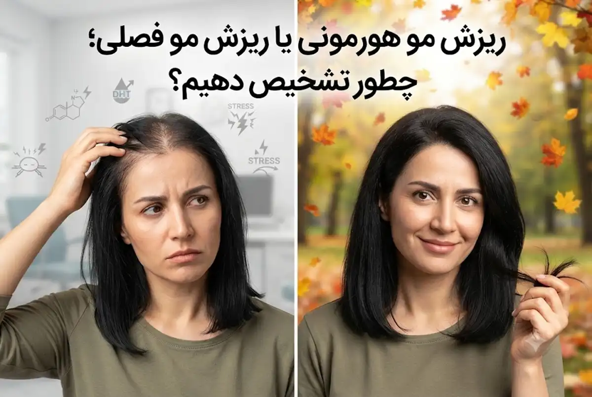 ریزش مو هورمونی یا ریزش مو فصلی؛ چطور تشخیص دهیم؟